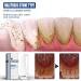 30 ml Tartar Cleaning Spray | Dental Discernation & Breath-Fresh Tartar Resolution Spray for Bad Breath Relief - Buy Online on GoSupps.com
