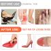 Adjustable Toe Filler Inserts for Loose Shoes - Wllhyf 2 Pairs Orange Shoe Pads for Men & Women - Buy Online on GoSupps.com
