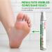 Cr me antifongique pour la peau : Cr me antifongique pour le pied d'athl te les d mangeaisons et la teigne - Formule douce - Convient aux pieds et au corps (18G 1-Pack) Vert - Buy Online on GoSupps.com