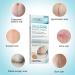 Medical Grade Silicone Scar Sheets - 5 Reusable Professional Gel Patches for Scar Removal - C-Section, Keloids, Tummy Tuck - Unscented, Washable - 5 Count - Buy Online on GoSupps.com