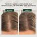 100% Pure Batana Oil for Hair Growth - Natural Raw Dr. Sebi Oil from Honduras | Enhance Hair Scalp & Skin - 4.22 fl. oz - Buy Online on GoSupps.com