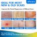 BORMSI Scar Cream Silicone Advanced Scar Treatment Gel - Repair Surgical Scars, Keloids, Stretch Marks, Acne - 1.76oz(50G) White - Buy Online on GoSupps.com