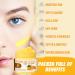 Turmeric & Kojic Body Butter - Natural Skin Brightening Lotion for Even Tone Scars & Sun Damage - Whipped Shea Butter Cream - Buy Online on GoSupps.com