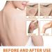 Buy Todahof Bienengiftsalbe - Effective Psoriasis Treatment Cream | Bienengift Sage (2PCs) | International Shipping Available - Buy Online on GoSupps.com