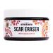 Better Shea Butter Scar Eraser Balm - Cocoa Butter Cream for Stretch Marks and Dark Spots Burns Old Scars - Acne Scars - Designed w Zero Synthetic Ingredients 4 oz