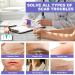 OK TAPE Silicone Scar Tape 1.5 x 2 yards Roll - Reusable Strips for Scar Removal from Burns, Surgery, Acne, Keloid, and Injury - Buy Online on GoSupps.com