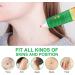 Skin Tag & Wart Remover Cream - Advanced Treatment Formula, Natural Ingredients - 20g - Buy Online on GoSupps.com