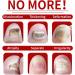 Fungal Nail Treatment Nail Fungus Treatment for Toenail Ingrown Toenail Treatment Toe Nail Fungal Treatment Fungal Nail Treatment for Toenails Extra Strong Nail Repair Treatment Repairing Broken Nail - Buy Online on GoSupps.com