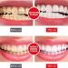 Artisan Probiotic Toothpaste for Sensitive Teeth - Brightening & Restorative Formula (1PC) - International Shipping - Buy Online on GoSupps.com