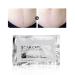 Scar Removal Cream for Tummy Scars | Reduce Formation of Connective Tissue | Easy to Use for Old and New Scars | 15 pcs - Buy Online on GoSupps.com