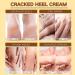 Coconut Cracked Heel Repair Cream Coconut Foot Cream For Cracked Heels & Dry Skin Foot Care Cream With Coconut Oil Callus Remover Nourishes Soften For Hand & Feet And Body - Buy Online on GoSupps.com