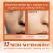 Aobenz Spot Remover for Face Dark Spot Remover for Face Anti Spot Serum Dark Spot Correcting Serum Skin Whitening Spot Treatment Freckle Remover Sun Spot Dark Spot Cream Brightening Serum 50ml - Buy Online on GoSupps.com