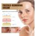 KOAHDE Freckle Removal Cream For Face Freckle Cream Anti Melasma Facial Moisturize Cream Moisturizing Anti-Blemish Cream Pigmentation Removal Cream for Face Skin Brightening Cream Dark Spot Corrector - Buy Online on GoSupps.com