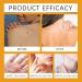 2PC Zoencgz New Bee Venom Repair Cream Bee Venom Tag Remover Bee Venom Cream Bee Venom Tag Removal Cream for All Skin Types Easy Application & No Irritation - Buy Online on GoSupps.com