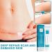 Advanced Scar Removal Cream for Old Scars - Targets Stretch Marks, Acne, Surgery, Burns & Injuries - Suitable for All Skin Types - Buy Online on GoSupps.com