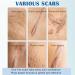 Scar Gel for Kids & Adults - Scar Cream Reduces Visibility of Scars & Decreases Tissue Tension & Itching - for All Types of Scars - Fast Absorption - Buy Online on GoSupps.com