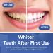 Luelli Teeth Whitening Kit - Fast Whitener with 3 Carbamide Peroxide Gel, Remineralization Gel, Whitening Light, Mouth Tray - Buy Online on GoSupps.com