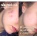 Skinetica Quintessence Face Toner 100ml - Acne & Blemish Treatment | Paraben-Free & Vegan | Gentle & Refreshing Formula for Sensitive Skin - Buy Online on GoSupps.com