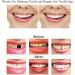 OTCPP Temporary Tooth Repair Kit - Teeth Veneers for Missing Tooth Support - Buy Online on GoSupps.com
