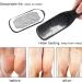 Foot Files Spa Hard Skin Removal Pedicure Care Set Callus Remover Washable Stainless Steel Double-Sides (Black and Red) Red and Black - Buy Online on GoSupps.com