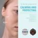 Micro Spot Care Patch - Self-Dissolving Acne Pimple Treatment | Target Zits & Blemishes with Patented 17mm Microdart Technology - Buy Online on GoSupps.com