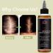 Huile de croissance des cheveux Lifewitqueenp Queenp Ayurvedic Hair Growth Huile l ger pour tous les types de cheveux 1Pcs - Buy Online on GoSupps.com