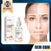Orgrul Turmeric Serum Turmeric Oil Turmeric Spot Correction Serum turmeric serum for the correction of dark spots Turmeric Dark Spot Corrector serum turmeric power against age spots 1 piece 1 piece - Buy Online on GoSupps.com