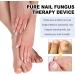 SenhE Fungus Laser Therapy Device Antibacterial Laser Equipment Light Therapy Device Fungal Nail Revolutionary High-Efficiency Light Therapy Device for Toenail Diseases  - Buy Online on GoSupps.com