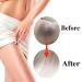 Intimate Areas Skin Lightening Cream for Private Parts Underarm Intimate Area Bikini Area Inner Thighs Knees Elbows Bleach Skin Bleaching Whitening Cream For Body (1.06 FL OZ) - Buy Online on GoSupps.com