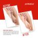 Probelle Advanced Total Foot Cream - Soothes, Hydrates, and Rejuvenates Rough, Dry, Cracked, and Sore Feet - 3 Ounces - Buy Online on GoSupps.com