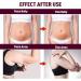 Slim Patch 2 x 30 pieces Slimming Patches Slimming Patch Weight Loss Anti Cellulite Patch Slim Fast Slimming Patch for Beer Belly Quickly Restores a Healthy Body and - Buy Online on GoSupps.com