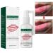 Mouth Ulcer Treatment Spray Mouth Ulcer Treatment for Adults Canker Sore Treatment Oral Care Spray Herbal Mouth Spray Canker Sores Relief Spray for Mouth Ulcer Bad Breath Treatment Mouth Freshener