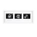 Pearhead Trimester Progression Sonogram Picture Frame, Pregnancy Milestone Keepsake Photo Frame, Gender-Neutral Baby Nursery Dcor, Mothers Day Accessory White