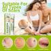 Scar Cream Gel 20g | Effective Keloid & Surgical Scar Removal | Professional Treatment for Old & New Scars | Gentle Formula for Face & Body - Buy Online on GoSupps.com