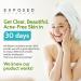 Exposed Skin Care Acne Treatment Kit - Complete Natural Solution for All Ages and Skin Types - Buy Online on GoSupps.com