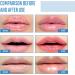 Collagen Lip Mask Pink Moisturizing Lip Patch Natural Collagen Lip Mask Overnight Anti-Aging And Anti-Chapped Reduce Lip Lines Under Lip Patches - Upgrade Lip Gel Pads (8pcs Blue) 8pcs Blue - Buy Online on GoSupps.com