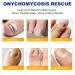Extra Strength Toenail Fungus Treatment - 32 Pcs Fungal Nail Patches for Nighttime Renewal & Discolored Nails - Buy Online on GoSupps.com