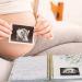 Pregnancy Journal & Memory Book with Stickers - Perfect Gift for First Time Moms - Track Your Baby's Journey - Buy Online on GoSupps.com