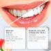 KLYso Radiant Teeth - Gentle Cleaning Stain Removal & Fresh Breath - Enamel Protection & Whitening Formula(2PCS) - Buy Online on GoSupps.com