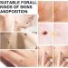 Skin Tag Tool Kit for Men and Women Micro Skin Tags Skin Tag Tool Kit for Small (2mm) to Medium (8.5mm) Skin Tags Fast and Easy to Operate Safe for Most - Buy Online on GoSupps.com
