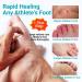 LMNOOP Athletes Foot Treatment Cream Maximum Strength - Antifungal Foot Cream for Itching, Blister, Burning, and Cracking - Natural Herbs - 1.76oz - Buy Online on GoSupps.com