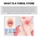 Tonsil Stone Remover Vacuum Kit - Gentle & Effective Oral Care Mouth Cleaner for Adults (2 Random Colors) - Buy Online on GoSupps.com