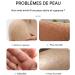 Foot Cream Softening Ointment 100g - Cracked Heel Cream - Quickly Softens Hard Skin Prevents Recurrent Dryness For Feet - Buy Online on GoSupps.com