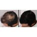 LUXE Hair Thickening Fibers - Hypoallergenic, Dermatologist Tested - 2 Months+ Supply in Dark Brown - Buy Online on GoSupps.com