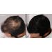 LUXE Hair Thickening Fibers for Instant Confidence - Hypoallergenic Dermatologist Tested 2+ Months Supply - Available in Multiple Colors (Blond - Buy Online on GoSupps.com