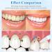 Dguso Gum Therapy Gel - Deep Cleaning Tooth Stains & Tartar (3 Pieces + Toothbrush) | Best Gum Shield Therapy - Buy Online on GoSupps.com
