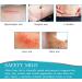 Silicone Surgical Scar Removal Patch for Trauma, Burn, Acne Treatment | Skin Repair Therapy - Buy Online on GoSupps.com