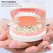 Buy Gold Braces Online | Universal Braces for Healthy Teeth | Upper & Lower Teeth Support - Buy Online on GoSupps.com