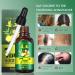 Ginger Germinal Oil Hair Growth Oil 2019 Hair Growth Serum Ginger Germinal Essential Oil Hair Loss Treatment Hair Care Hair Growth Serum Repairs Hair Follicles Promotes Thicker Hair Regrowth-30ml - Buy Online on GoSupps.com