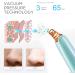 Blackhead Remover Pore Vacuum Cleaner - Electric USB Facial Pore Cleaner with 5 Probes - Upgraded Blackhead Suction Tool Kit (Green) - Buy Online on GoSupps.com